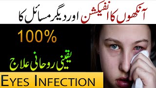 Aankhon Kay Infection Se Shifa Ka Taweez  Taweez For All Eye Problems  Treatment of Eye Diseases [upl. by Murat]