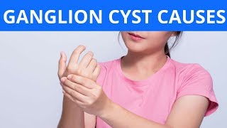 Ganglion Cyst Causes [upl. by Dnilazor382]