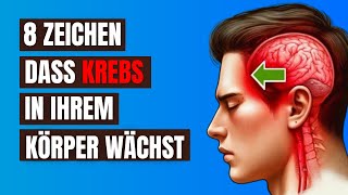 Vernachlässigen Sie Nicht Diese 8 Frühen Anzeichen von Krebs  Sie könnten Ihr Leben retten [upl. by Kerred483]