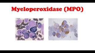 Cytochemistry 🔤  Myeloperoxidase Stain [upl. by Nirra]