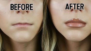 HOW TO FAKE LIP FILLERS  Noel Labb [upl. by Sybyl820]