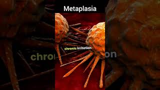 Metaplasia pharmacy cancer science shorts nursing biology [upl. by Areis340]