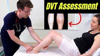 Deep Vein Thrombosis DVT OSCE Clinical Examination  Plus DVT risk factors diagnosis amp treatment [upl. by Primo]