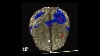 Kinesio effect on cortical brain activity fMRI [upl. by Venn516]