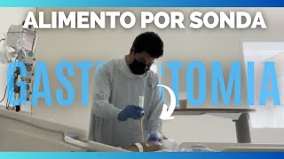 ¿COMO ADMINISTRAR una ALIMENTACION POR SONDA de GASTROSTOMIA  VIDEO PRACTICO [upl. by Ahsinra]