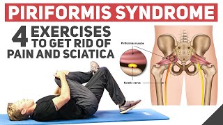 Piriformis Syndrome  Home Stretches amp Exercises [upl. by Enylhsa]