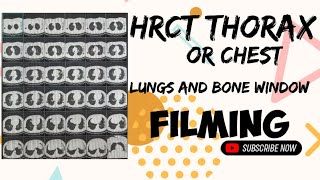 😮‍💨HOW TO DO HRCT THORAXCHEST FILMING PROCESS  LUNGS AND BONE WINDOW FILMING🎞 [upl. by Barrada]