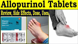 Allopurinol tablets ip 100mg  Review 100mg zyloric tablets  Uses Side Effects Dosage [upl. by Sinnej638]