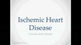 Ischemic Heart Disease  USMLE Step 2 Review [upl. by Enasus597]