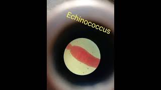 Echinococcus shorts shortsvideo youtubeshorts [upl. by Eednus]