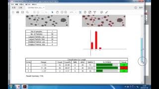 particle size analysis software [upl. by Syah413]