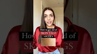 How to get rid of skin tags with pcos [upl. by Reuben]