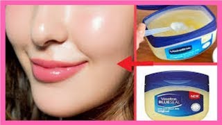 How to remove Blackheads from Lips [upl. by Silsby]