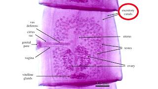 Diphyllobothrium Latum [upl. by Chester641]