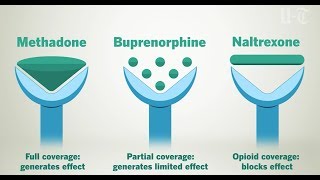 How Opioid Treatment Medications Work On Your Brain  San Diego UnionTribune [upl. by Morrie412]