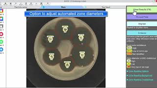 Disk Diffusion Zone Reader  BIOMIC V3 Microbiology System [upl. by Ahsenad]