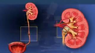 Litotripsia Extracorpórea por Ondas de Choque Urología Peruana Dr Luis Susaníbar [upl. by Nidroj153]