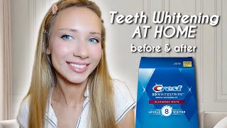 Crest 3D WHITESTRIPS Before amp After  AtHome Teeth Whitening [upl. by Ingram]