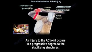 Acromioclavicular Joint Injury AC separation  Everything You Need To Know  Dr Nabil Ebraheim [upl. by Oneida950]