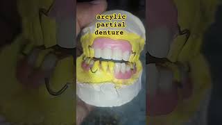 acrylic partial denture by ali dental art 😁😁😁😁😁partialdenture orthodontist completedenture [upl. by Aimek]