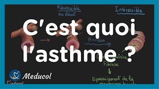 Lasthme cest quoi physiopathologie causes symptômes et traitement [upl. by Ahasuerus]