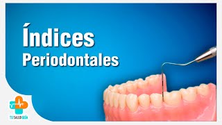 Índices Periodontales  Tu Salud Guía [upl. by Meneau]