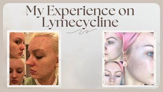 LYMECYCLINE EXPERIENCE [upl. by Ardnad80]