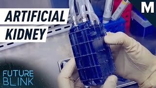 This Artificial Kidney Functions Only On Blood Pressure  Mashable [upl. by Malone290]