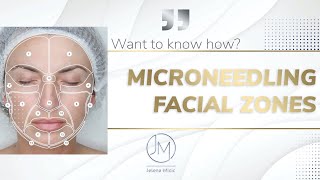 Microneedling technique step by step [upl. by Genie403]