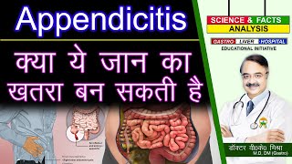 क्या ये जान का ख़तरा बन सकती है  APPENDICITIS FACTS [upl. by Naylor301]