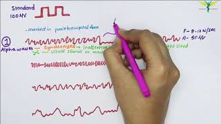 Electroencephalogram EEG  Waves  Physiology [upl. by Annoved]