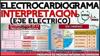 ELECTROCARDIOGRAMA INTERPRETACIÓN  GuiaMed [upl. by Oleta910]