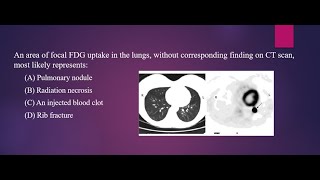 FDG PET for the Evaluation of pulmonary nodule MCQ SCFHS PETCT PETCT nuclearmedicineMCQ [upl. by Doner]