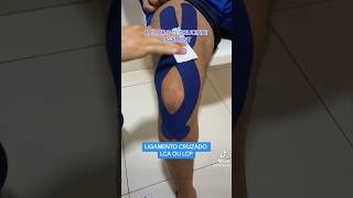 COMO COLOCAR KINESIO NO JOELHO PARA LCA OU LCP dicas fisio kinesiotape fisioterapia joelho [upl. by Ylirama388]