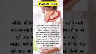 Placenta Previa condition in pregnancy healthfacts pregnancyjourney pregnancy pregnancyfacts [upl. by Yerdna]