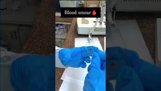 Blood Smear Under microscope 🔬 microscope wbc microbiology ytshorts labtechnician yt biology [upl. by Iran]