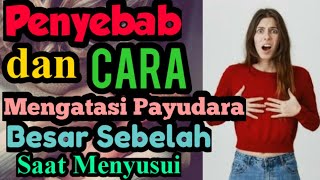 PENYEBAB DAN 3 CARA MENGATASI PAYUDARA BESAR SEBELAH SAAT MENYUSUI [upl. by Eng]