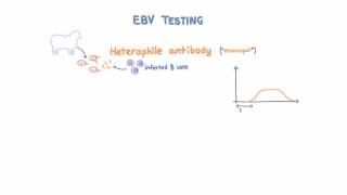 Epstein Barr Virus EBV Diagnosis and Testing [upl. by Plate]