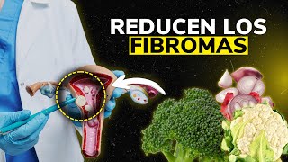 REDUCE los FIBROMA en 30 dias con este TRUCO [upl. by Goetz103]