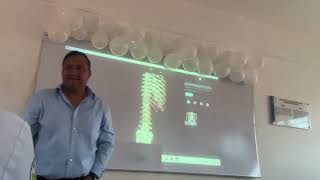 clase de anfiteatro musculos vertebrales parte 2 [upl. by Eerok6]