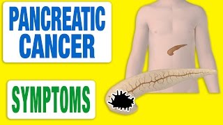 Pancreatic Cancer  All Symptoms [upl. by Danby416]