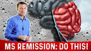 How To Put Multiple Sclerosis MS In Remission – DrBerg [upl. by Drews154]