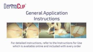 DermaClip Applying the Device Instructional Video [upl. by Eugenia]