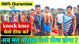 Knock knee kaise thik kare 😱 knock knee solution  knock knee best exercise  knock knee treatment [upl. by Olleina]