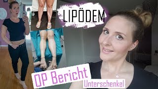 Lipödem  OP Bericht  Meine UnterschenkelOP  LipoClinic  Teil 1 [upl. by Farlay]