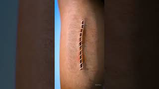 Wound healing process 3D video Shorts shorts shortsfeed funny [upl. by Nedia]