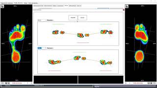 Webinar Plataformas de Presiones Dynamo [upl. by Ennazus155]