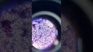 Gram positive cocci [upl. by Rhyne]