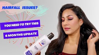 Best shampoo for hairfall  Jyoti Singh [upl. by Paolina]