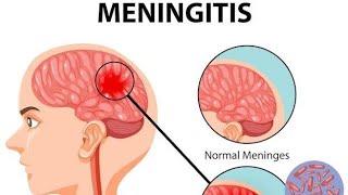 Meningitis  Part 1  Pathology  Harsh Mohan  Notes  Easy Explanation [upl. by Novj]